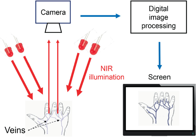 NIR Vein Imaging