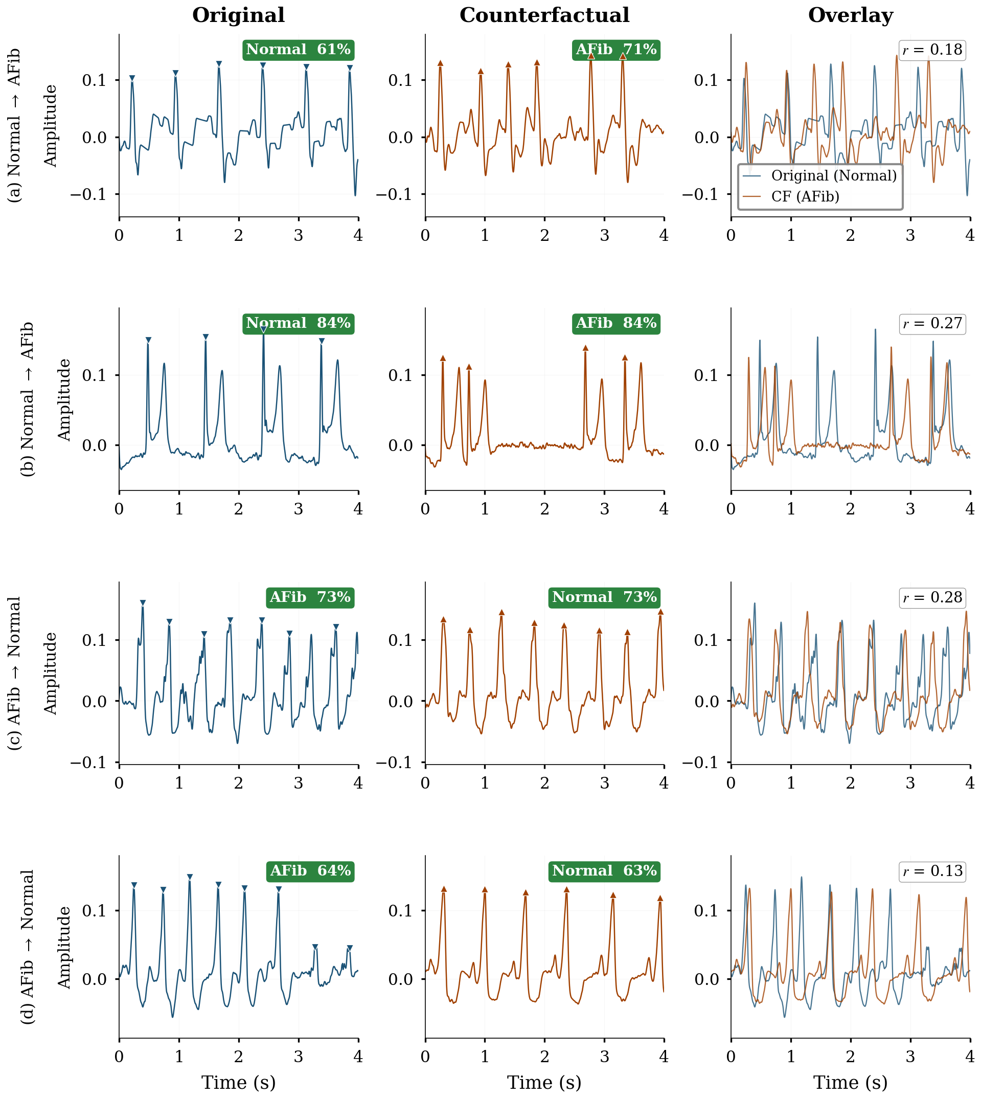 ECG Comparison