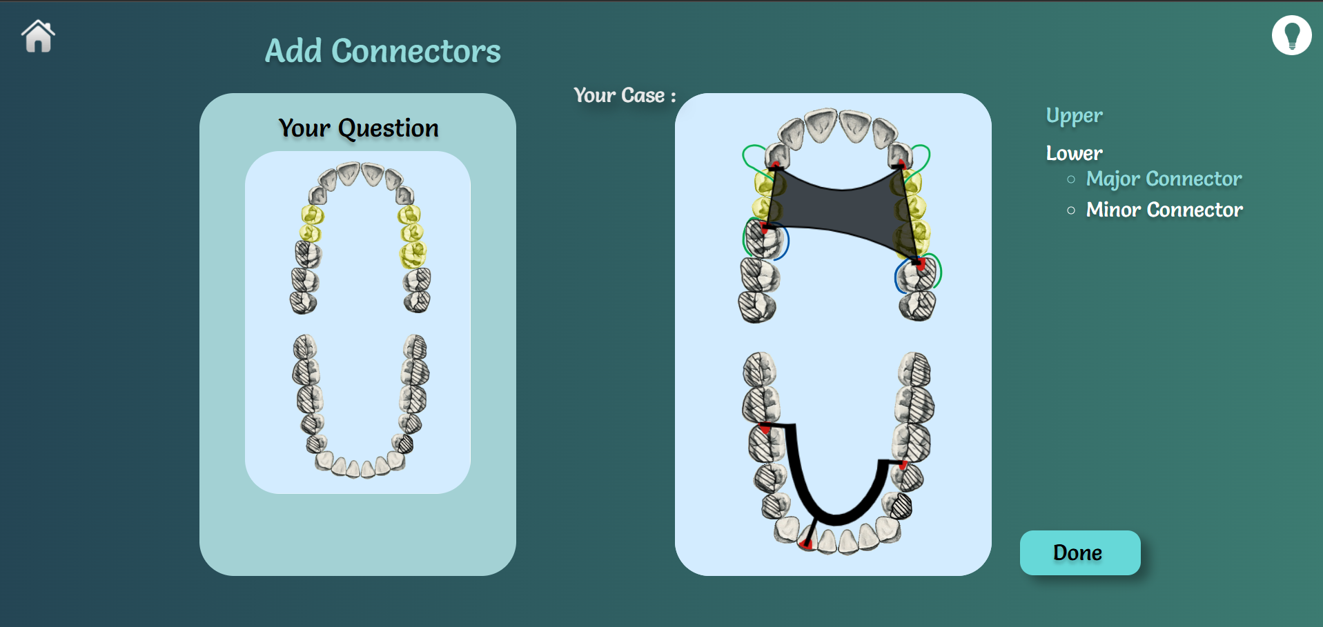 Denture Design Tool