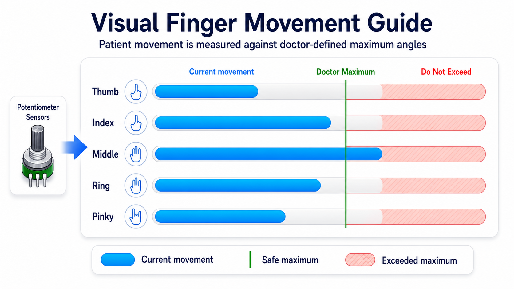 Five visual sliders comparing each finger's live angle with its doctor-defined maximum and exceeded-limit zone