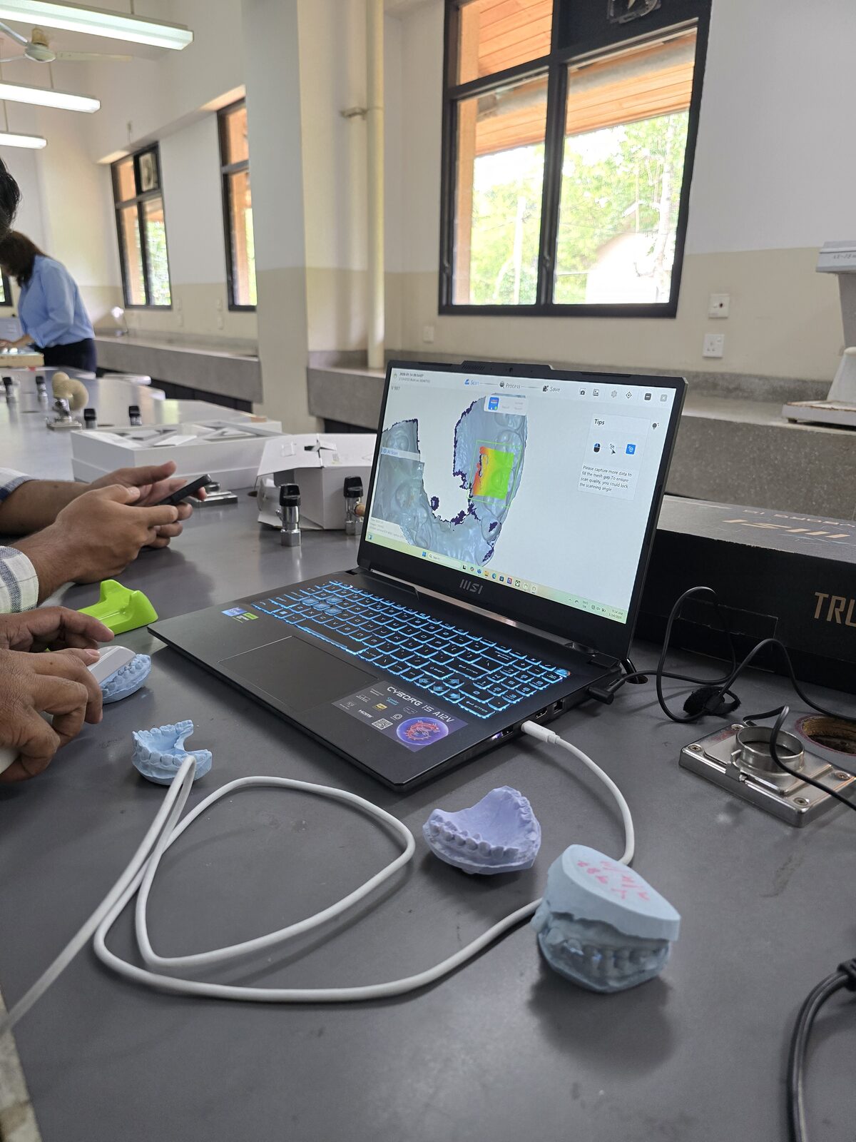 Team member reviewing a live 3D scan of a dental cast on a laptop, with physical plaster casts on the table
