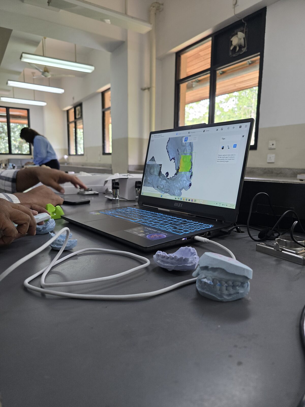 A second angle of the 3D scanning session, showing the scan preview and physical dental casts being prepared