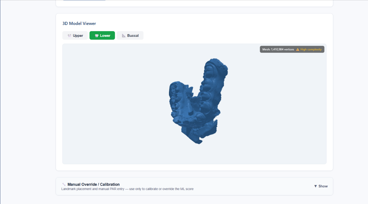 Three.js 3D model viewer displaying an uploaded lower arch STL scan with Upper/Lower/Buccal tabs